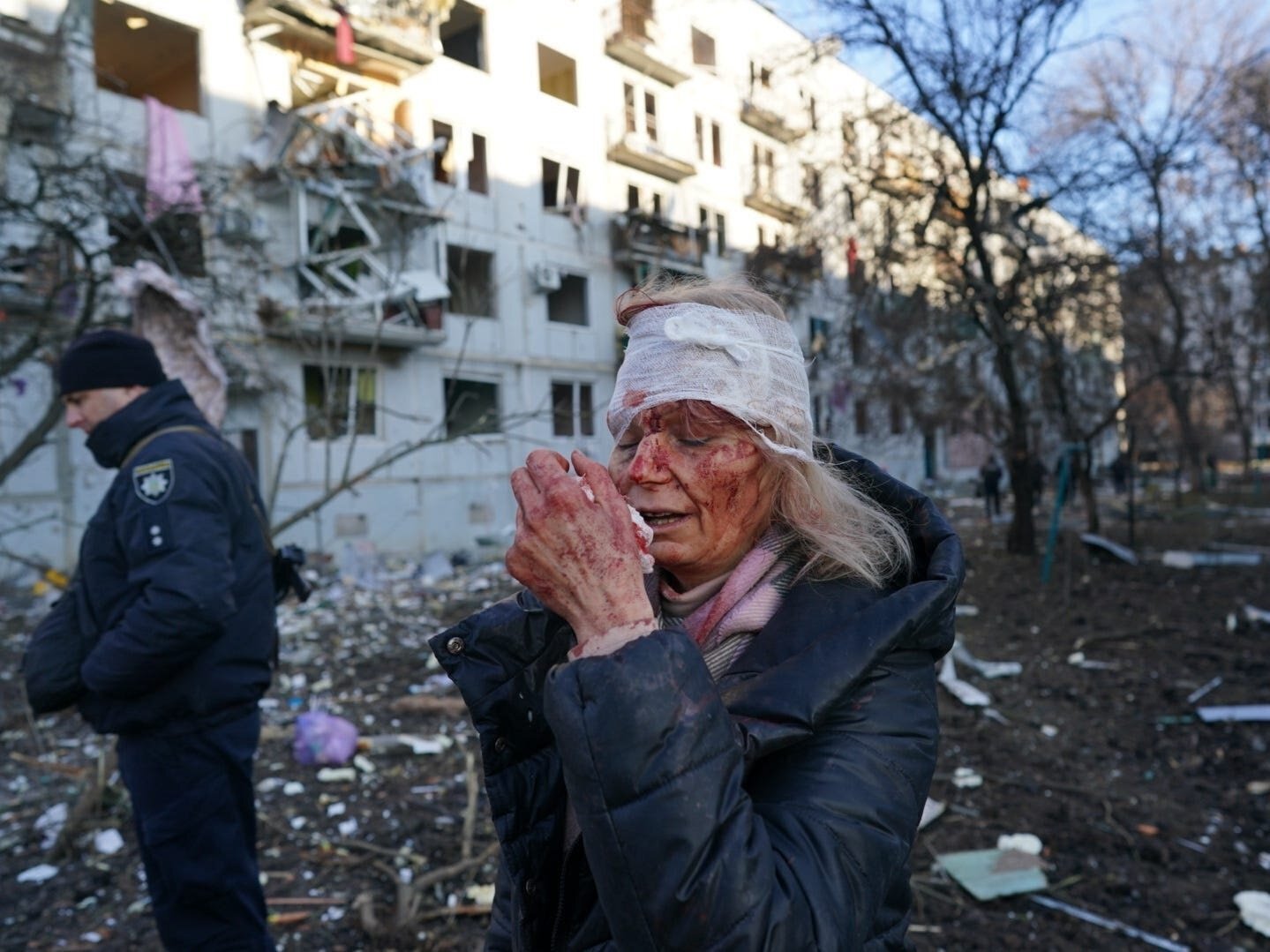 Ужасы войны на украине телеграмм фото 70