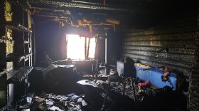 Мужчина пострадал при тушении пожара в Белозерске