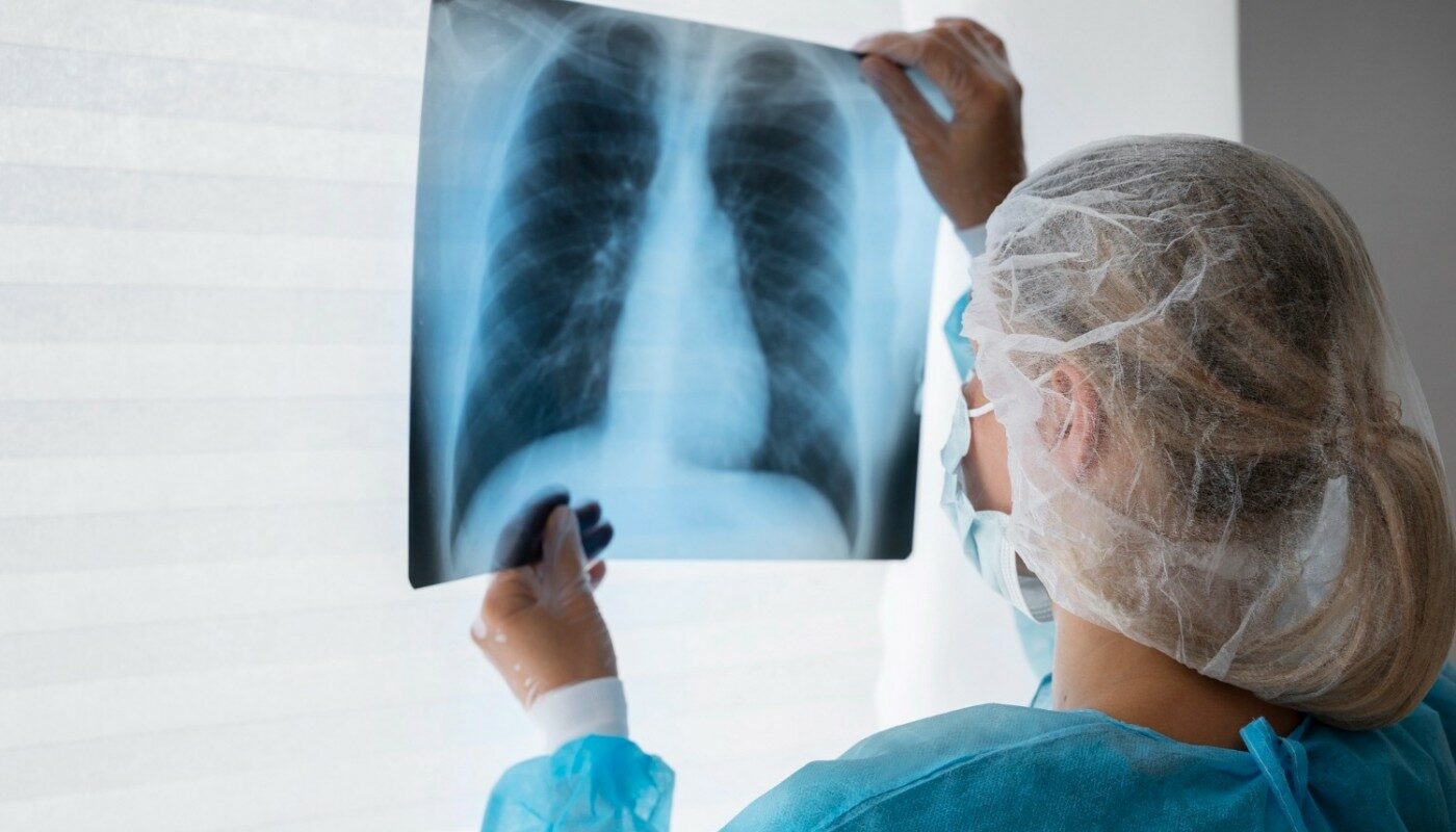 «Предлагаем запись на флюорографию». Почему нужно бояться звонка из поликлиники