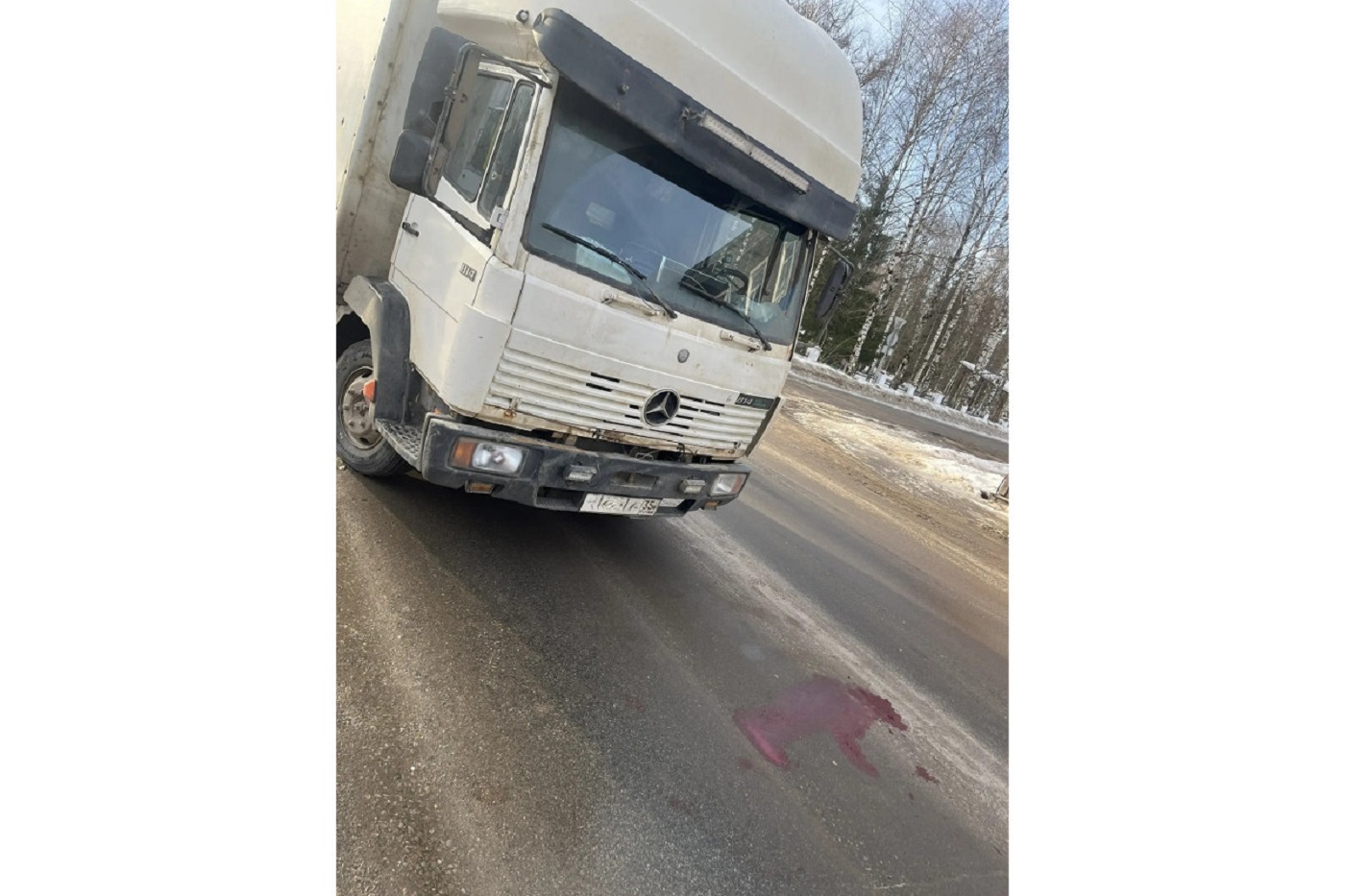 Устюжанка попала под колеса грузовика