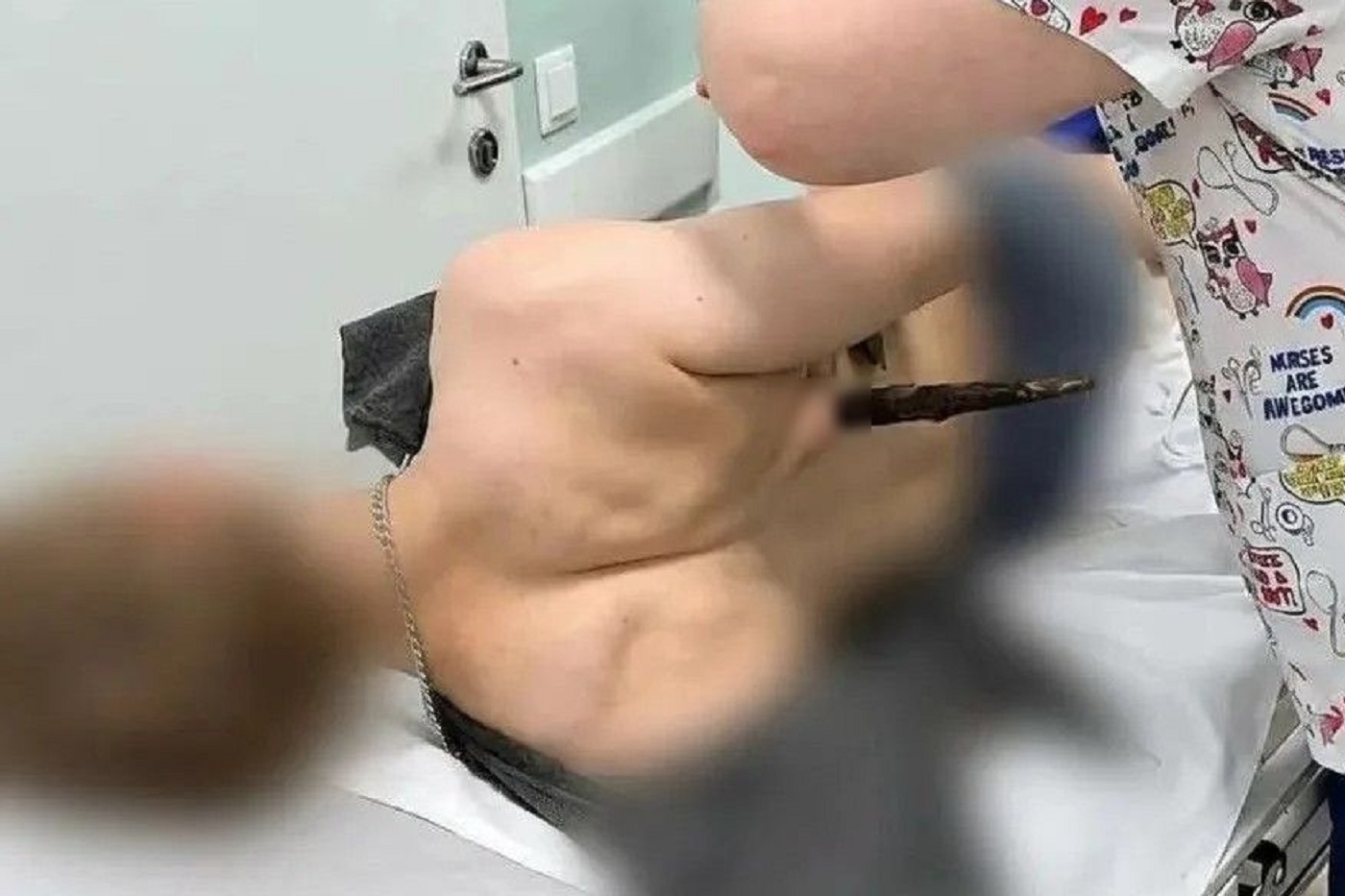 18-летний череповчанин оказался на волосок от гибели после катания на квадроцикле